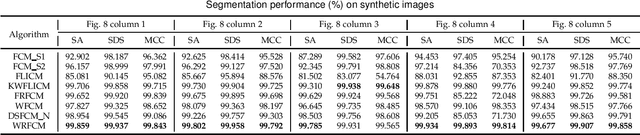 Figure 2 for Residual-driven Fuzzy C-Means Clustering for Image Segmentation