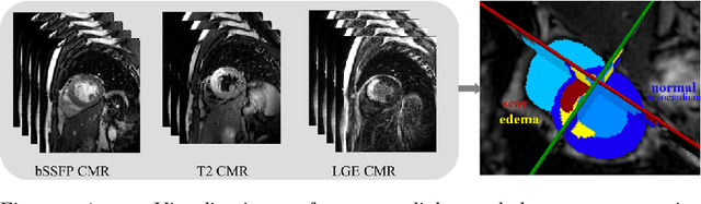 Figure 1 for Multi-Modality Cardiac Image Analysis with Deep Learning