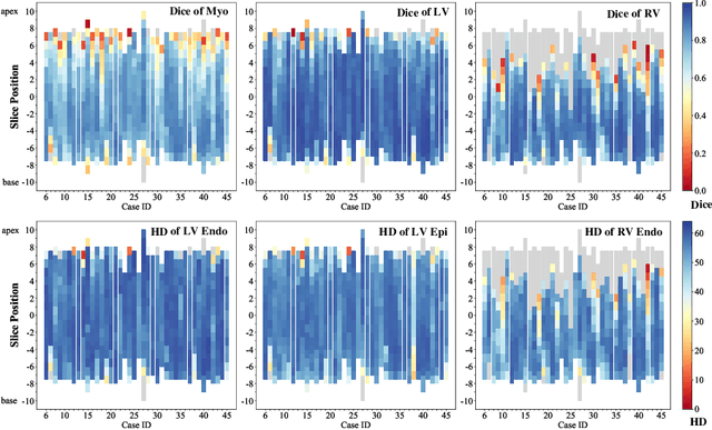 Figure 3 for Multi-Modality Cardiac Image Analysis with Deep Learning