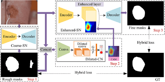 Figure 2 for Semi- and Weakly Supervised Directional Bootstrapping Model for Automated Skin Lesion Segmentation