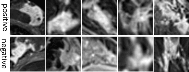 Figure 3 for Constrained Deep One-Class Feature Learning For Classifying Imbalanced Medical Images
