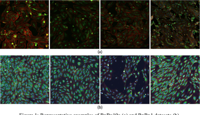 Figure 1 for Exploiting generative self-supervised learning for the assessment of biological images with lack of annotations: a COVID-19 case-study