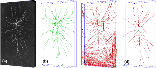 Figure 1 for 3D WaveUNet: 3D Wavelet Integrated Encoder-Decoder Network for Neuron Segmentation