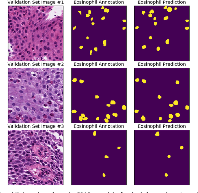 Figure 2 for Advancing Eosinophilic Esophagitis Diagnosis and Phenotype Assessment with Deep Learning Computer Vision