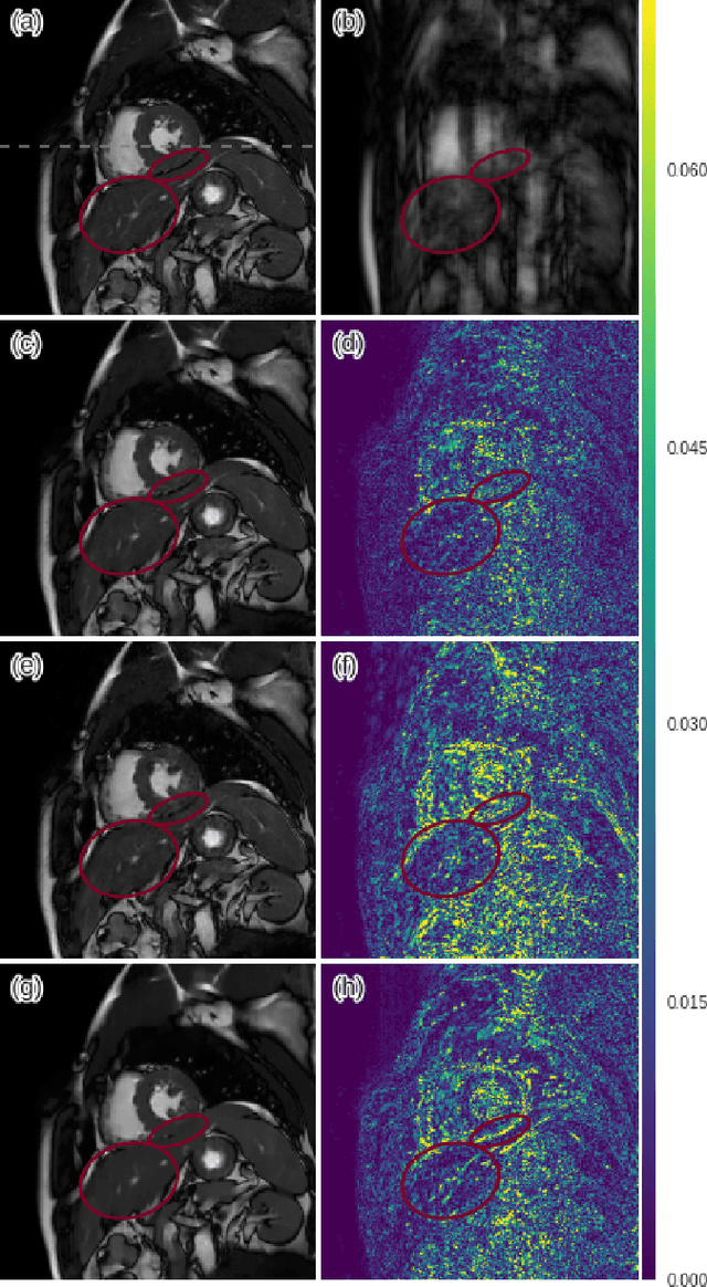 Figure 3 for A Deep Cascade of Convolutional Neural Networks for Dynamic MR Image Reconstruction