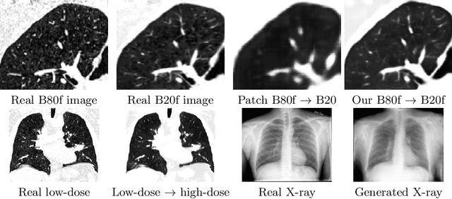 Figure 4 for Multi-scale GANs for Memory-efficient Generation of High Resolution Medical Images