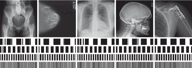 Figure 2 for Radon Features and Barcodes for Medical Image Retrieval via SVM