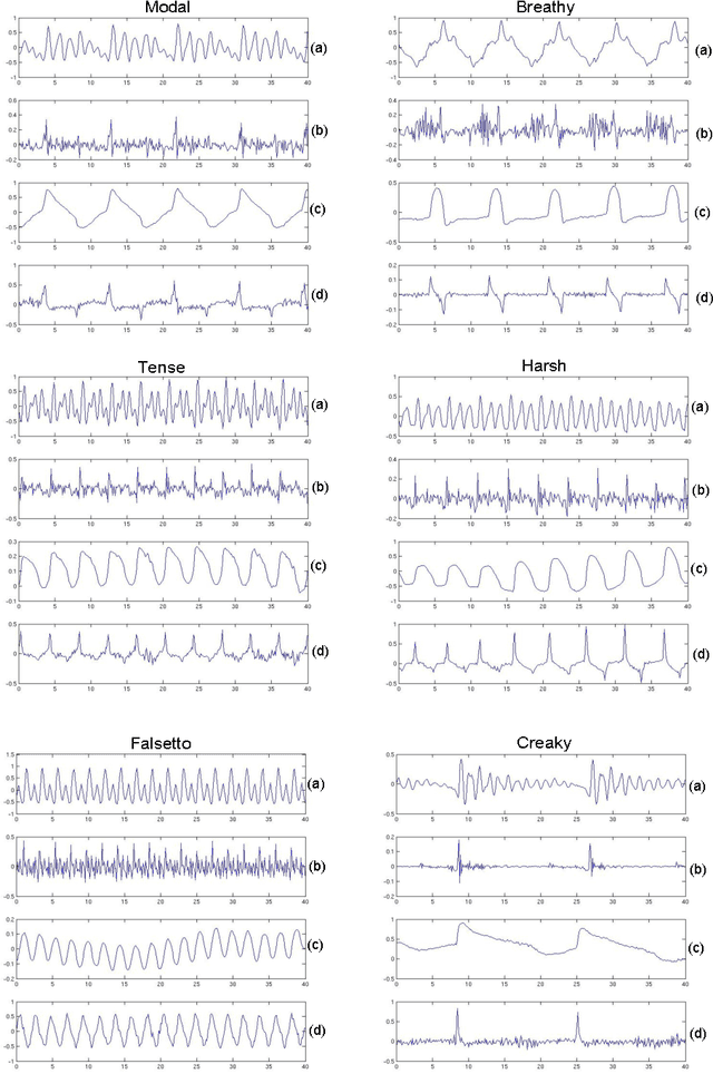 Figure 4 for Glottal Source Processing: from Analysis to Applications