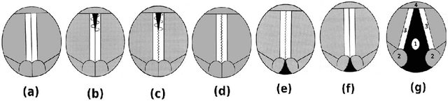Figure 2 for Glottal Source Processing: from Analysis to Applications