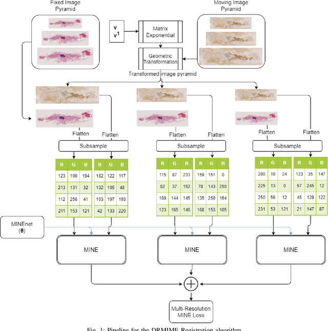 Figure 1 for DRMIME: Differentiable Mutual Information and Matrix Exponential for Multi-Resolution Image Registration