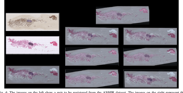 Figure 4 for DRMIME: Differentiable Mutual Information and Matrix Exponential for Multi-Resolution Image Registration