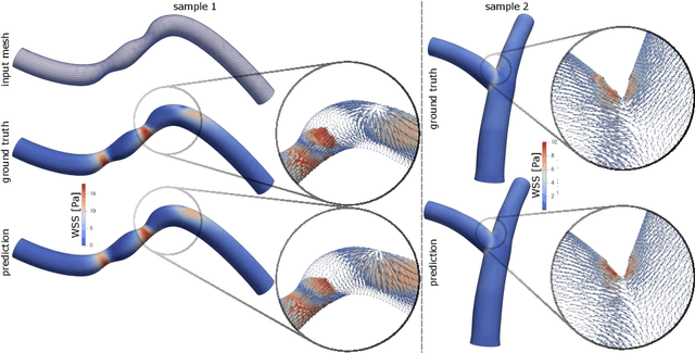 Figure 4 for Mesh convolutional neural networks for wall shear stress estimation in 3D artery models