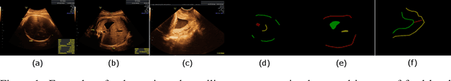 Figure 1 for DTU-Net: Learning Topological Similarity for Curvilinear Structure Segmentation