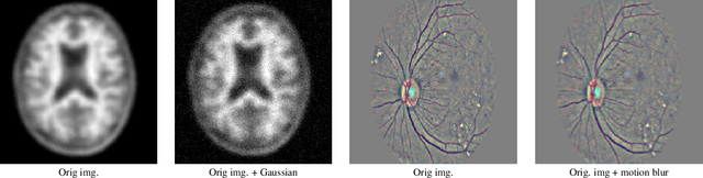 Figure 4 for An Experimental Study of Data Heterogeneity in Federated Learning Methods for Medical Imaging