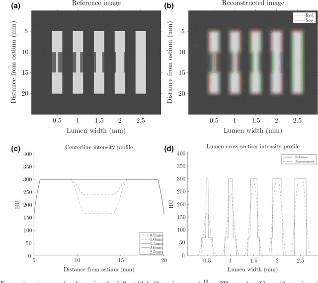 Figure 1 for Improving CCTA based lesions' hemodynamic significance assessment by accounting for partial volume modeling in automatic coronary lumen segmentation