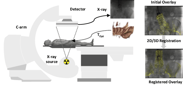 Figure 1 for Self-Supervised 2D/3D Registration for X-Ray to CT Image Fusion