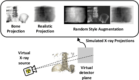 Figure 3 for Self-Supervised 2D/3D Registration for X-Ray to CT Image Fusion