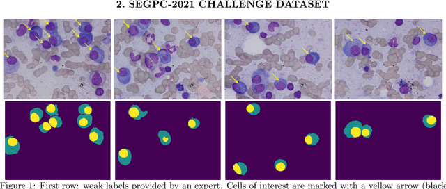 Figure 1 for Segmentation of Multiple Myeloma Plasma Cells in Microscopy Images with Noisy Labels