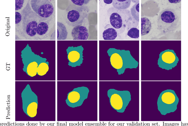 Figure 4 for Segmentation of Multiple Myeloma Plasma Cells in Microscopy Images with Noisy Labels