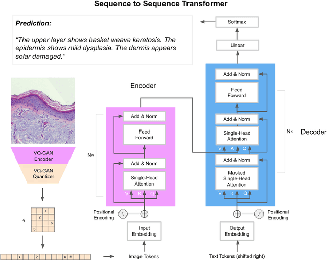Figure 4 for Towards Highly Expressive Machine Learning Models of Non-Melanoma Skin Cancer