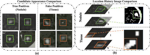 Figure 3 for 3DFPN-HS$^2$: 3D Feature Pyramid Network Based High Sensitivity and Specificity Pulmonary Nodule Detection