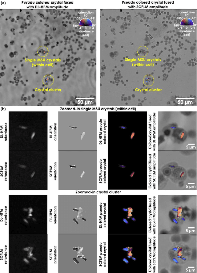 Figure 2 for Deep learning-based holographic polarization microscopy