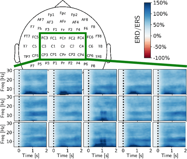 Figure 2 for On the use of generative deep neural networks to synthesize artificial multichannel EEG signals