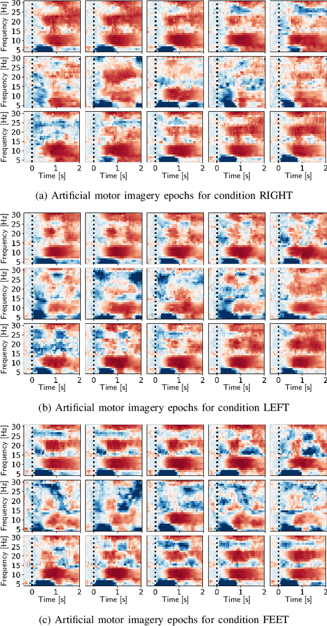 Figure 3 for On the use of generative deep neural networks to synthesize artificial multichannel EEG signals