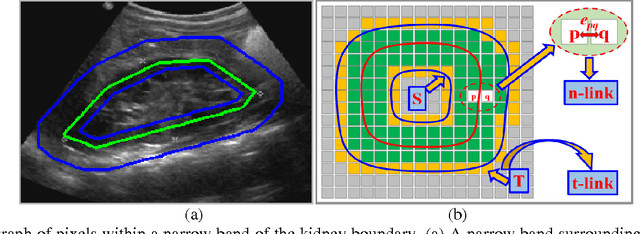 Figure 3 for A dynamic graph-cuts method with integrated multiple feature maps for segmenting kidneys in ultrasound images
