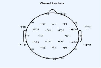 Figure 1 for Spoken Speech Enhancement using EEG