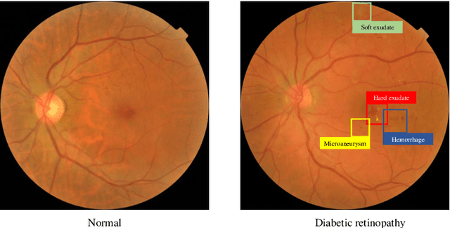 Figure 1 for Identifying the key components in ResNet-50 for diabetic retinopathy grading from fundus images: a systematic investigation