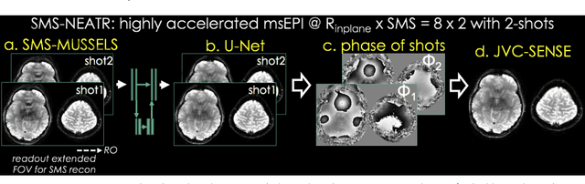 Figure 1 for Highly Accelerated Multishot EPI through Synergistic Combination of Machine Learning and Joint Reconstruction