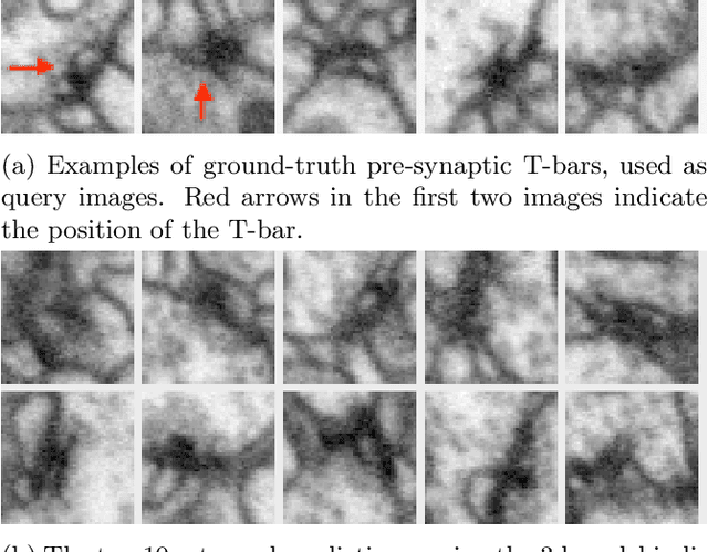 Figure 1 for Latent Feature Representation via Unsupervised Learning for Pattern Discovery in Massive Electron Microscopy Image Volumes
