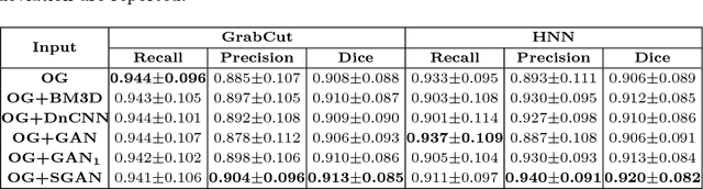 Figure 2 for CT Image Enhancement Using Stacked Generative Adversarial Networks and Transfer Learning for Lesion Segmentation Improvement