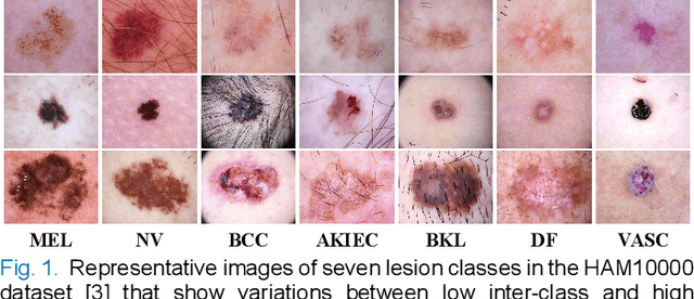 Figure 1 for Single Model Deep Learning on Imbalanced Small Datasets for Skin Lesion Classification