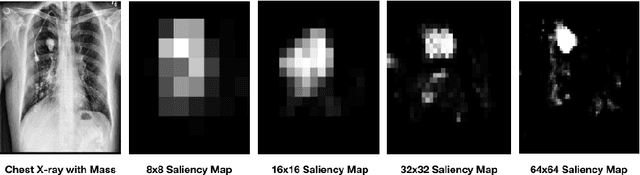 Figure 1 for Weakly Supervised Medical Diagnosis and Localization from Multiple Resolutions
