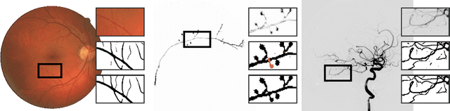 Figure 1 for The Minimum Cost Connected Subgraph Problem in Medical Image Analysis