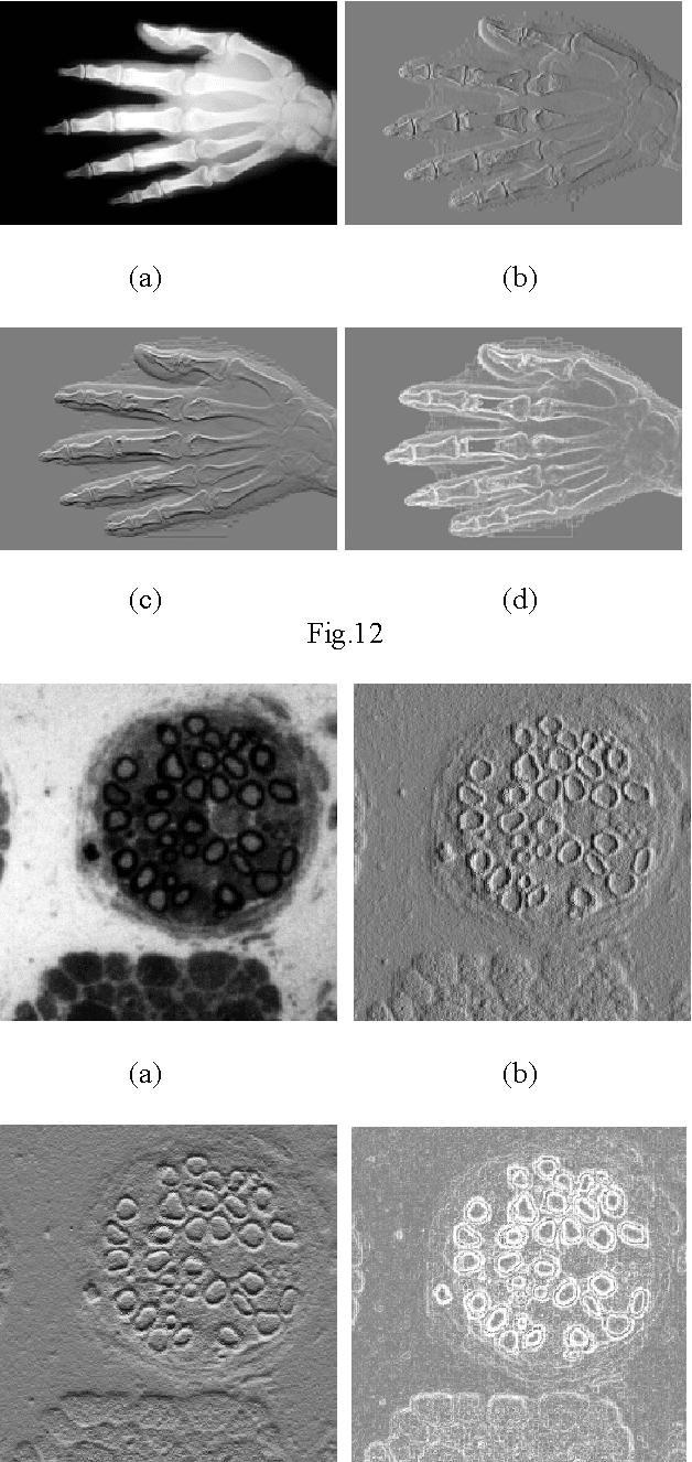 Figure 2 for A Mathematical Model for Logarithmic Image Processing