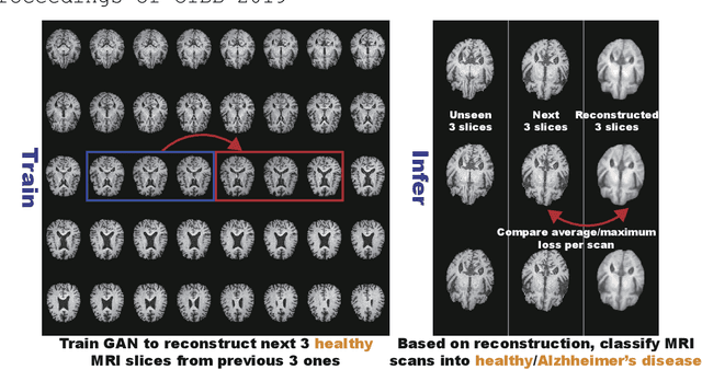 Figure 1 for GAN-based Multiple Adjacent Brain MRI Slice Reconstruction for Unsupervised Alzheimer's Disease Diagnosis