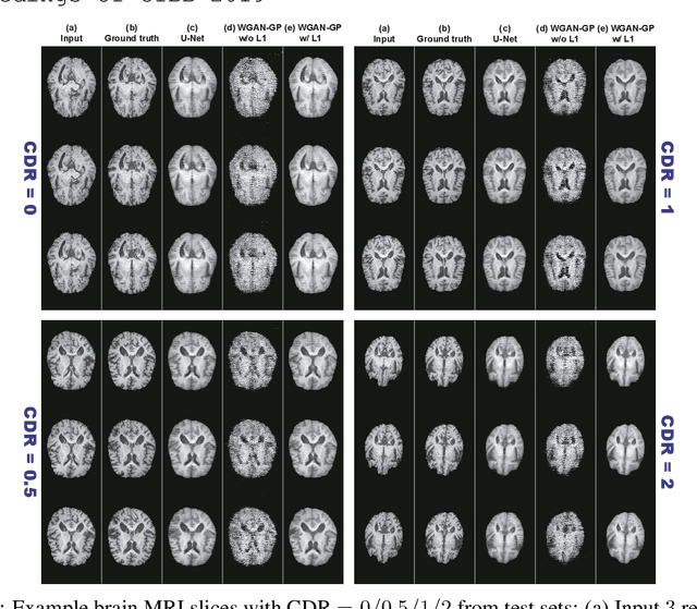 Figure 2 for GAN-based Multiple Adjacent Brain MRI Slice Reconstruction for Unsupervised Alzheimer's Disease Diagnosis