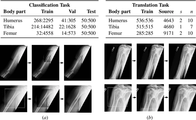 Figure 4 for Generative Image Translation for Data Augmentation of Bone Lesion Pathology
