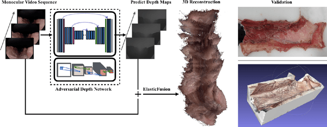 Figure 1 for SLAM Endoscopy enhanced by adversarial depth prediction