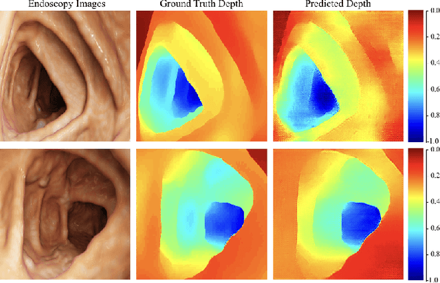 Figure 4 for SLAM Endoscopy enhanced by adversarial depth prediction