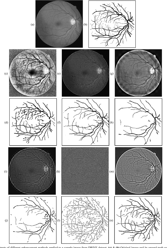 Figure 3 for A Retinal Image Enhancement Technique for Blood Vessel Segmentation Algorithm