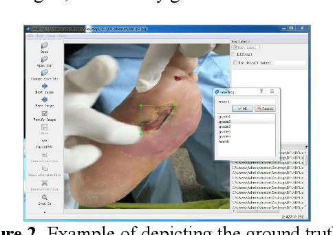 Figure 3 for Efficient refinements on YOLOv3 for real-time detection and assessment of diabetic foot Wagner grades