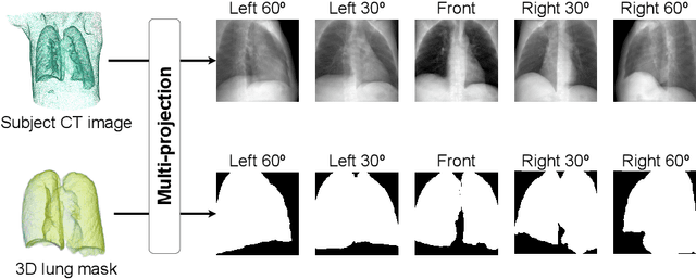 Figure 1 for AI-based computer-aided diagnostic system of chest digital tomography synthesis: Demonstrating comparative advantage with X-ray-based AI systems