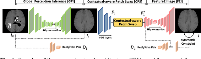 Figure 1 for Symmetric-Constrained Irregular Structure Inpainting for Brain MRI Registration with Tumor Pathology