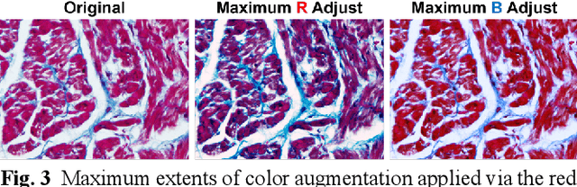 Figure 4 for Segmentation of histological images and fibrosis identification with a convolutional neural network