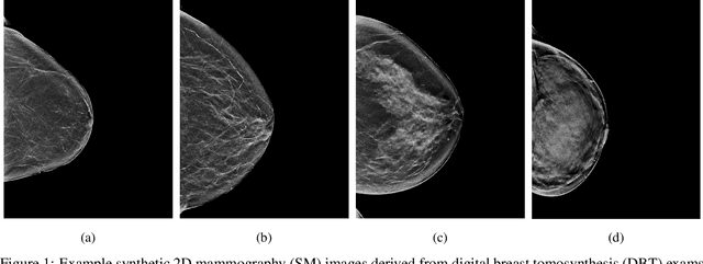 Figure 1 for A multi-site study of a breast density deep learning model for full-field digital mammography and digital breast tomosynthesis exams