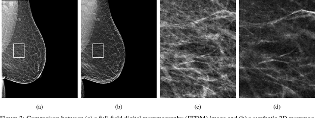 Figure 3 for A multi-site study of a breast density deep learning model for full-field digital mammography and digital breast tomosynthesis exams